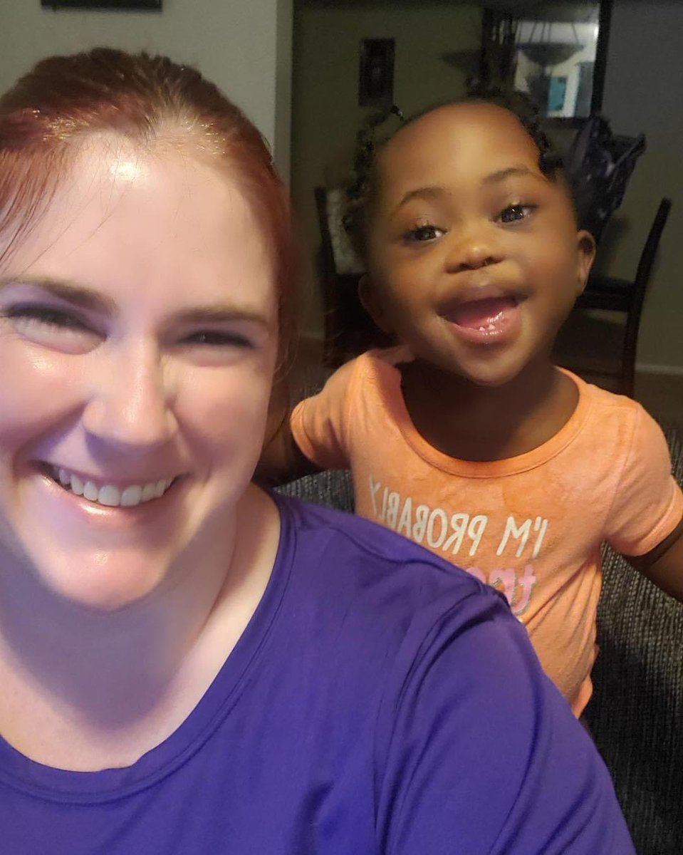 SproutPeds's tweet image. Hard work can be fun! Lariyah is all smiles after playing with Ms Emily. 😀 
#grossmotorskills #grossmotordevelopment #play #pt #physicaltherapy #downsyndrome #downsyndromeawareness #downsyndromelove