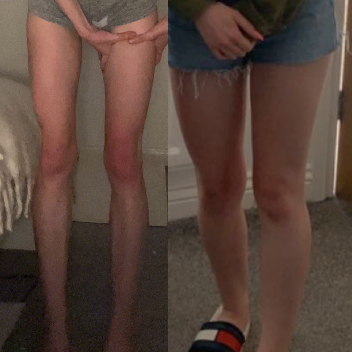 honeyymatcha's tweet photo. God im fucking speechless hw vs bmi 14 (ik the angles are off but wth) https://t.co/JYY9GHZlPZ