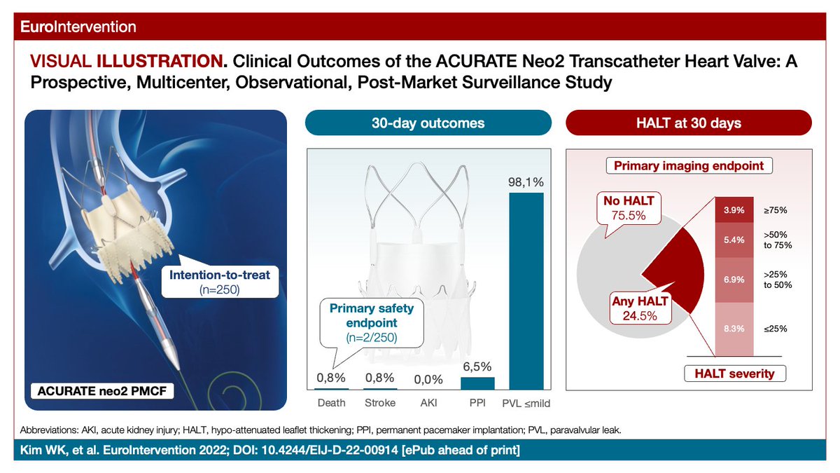 Davide Capodanno (@dfcapodanno) on Twitter photo #PCRLV simultaneous publication: in the multicentre ACURATE neo2 PMCF study, patients treated with the ACURATE neo2 had a low pacemaker implantation rate, early improvements in valve haemodynamics, and a low rate of moderate or greater paravalvular leak. eurointervention.pcronline.com/article/clinic… #PCRLV simultaneous publication: in the multicentre ACURATE neo2 PMCF study, patients treated with the ACURATE neo2 had a low pacemaker implantation rate, early improvements in valve haemodynamics, and a low rate of moderate or greater paravalvular leak. eurointervention.pcronline.com/article/clinic…