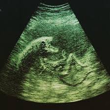 i just got my ultrasound 💖 #SecondTrimester
