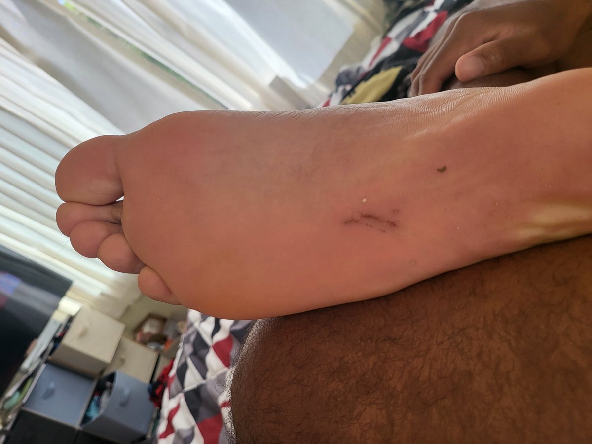 sirnutsalot21's tweet photo. Cut my foot at the beach, get to kissing my foot better beta$
#SundayFunday #footdom #malefeet #kissitbetter #alphasole https://t.co/63Sg434vcs
