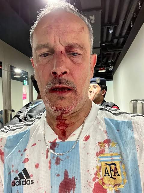 Jakewed321's tweet photo. @kufa_0310 @miguelcarlosloz @lolyluzzz @tendenciasposta No te proyectes sudaquita con hambre. Veo tu cara y no se si eres hincha de Argentina o de Arabia Saudí, cara de moro desnutrido. Luego porque quedan como quedan y se hacen las víctimas. https://t.co/jqq9CTpA7Q