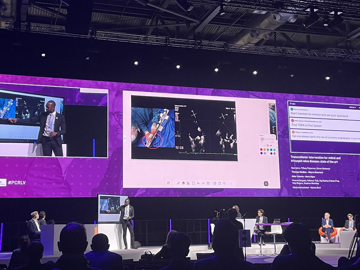 am_ioppolo's tweet photo. Amazing session about state of the art of transcatheter intervention for mitral and tricuspid valve disease..live from #PCRLV @PCRonline @didier_tchetche @modine_thomas https://t.co/dshkClXSmA