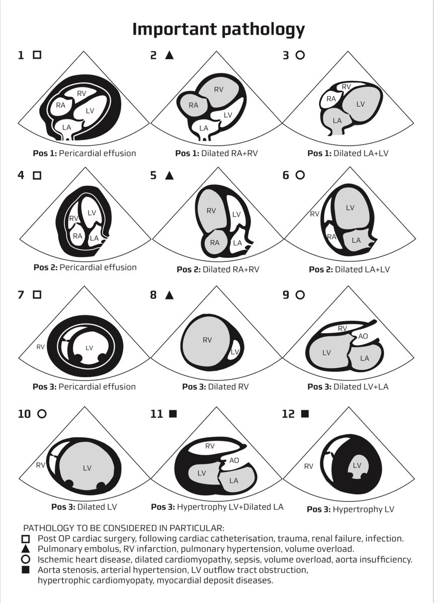 NephroP's tweet photo. Focus assessed transthoracic #echofirst (#FATE) cards 🫀🗂️: 
1. basic, 2. extended, and 3. pathologies.
Courtesy: https://t.co/0TFeHbBkfg
#POCUS #MedTwitter #FOAMed https://t.co/db2pt2CdTW