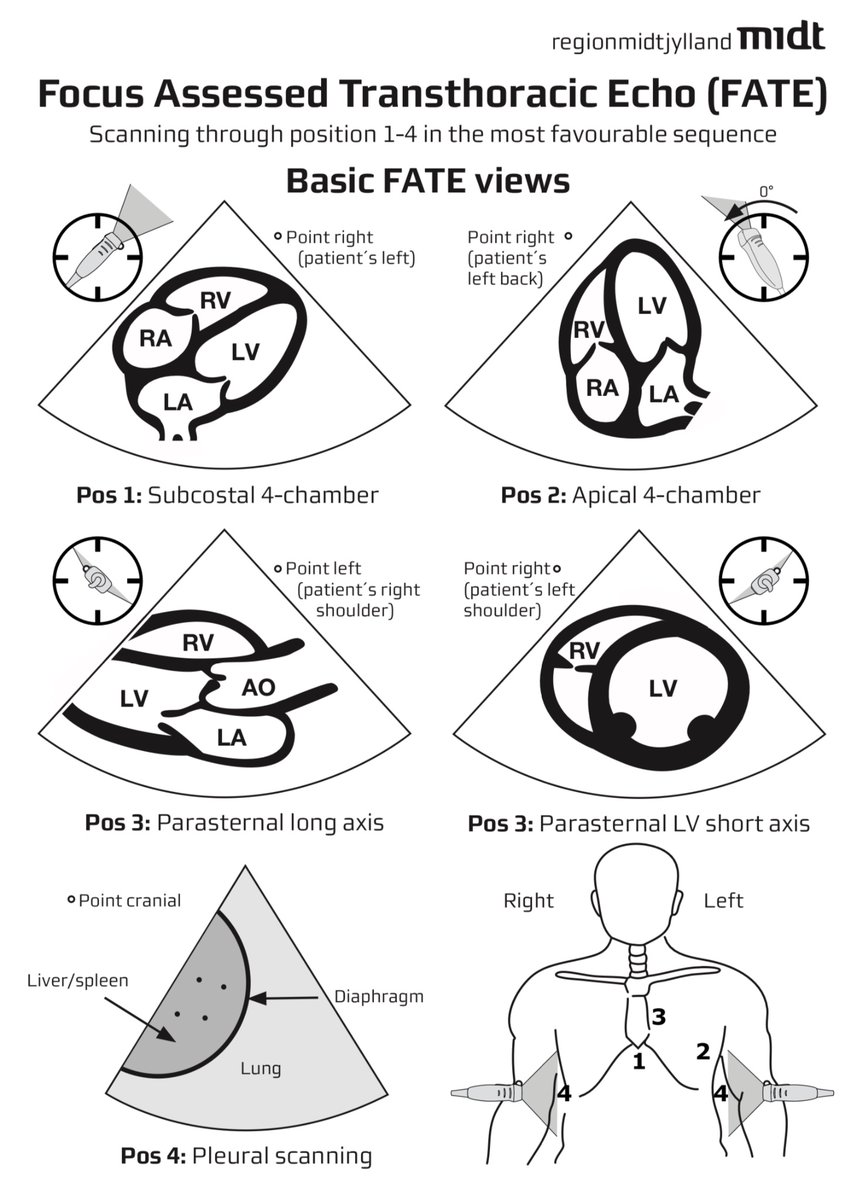 NephroP's tweet photo. Focus assessed transthoracic #echofirst (#FATE) cards 🫀🗂️: 
1. basic, 2. extended, and 3. pathologies.
Courtesy: https://t.co/0TFeHbBkfg
#POCUS #MedTwitter #FOAMed https://t.co/db2pt2CdTW