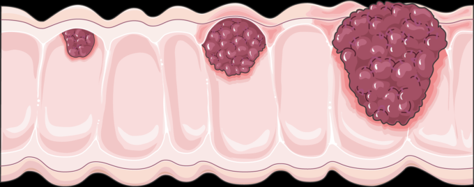 BiblioEASP's tweet photo. #Produccioncientifica @EASPsalud Pre-Diagnostic Circulating Resistin Concentrations Are Not Associated with #ColorectalCancer Risk in the European Prospective Investigation into Cancer and Nutrition Study @mjsanchezperez #EASPdivulga #Resistin https://t.co/Mtk9oDGmSo https://t.co/A6gFr4EGK4