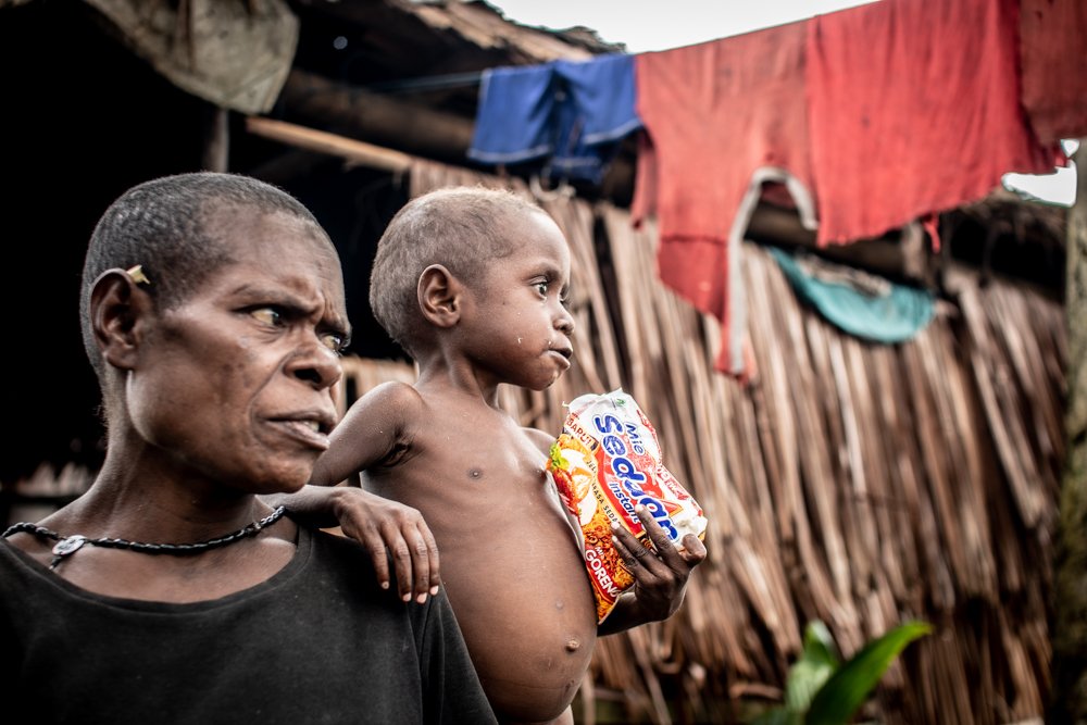 “Food War” oleh Andreas Wahyu berangkat dari fenomena maraknya anak-anak di Asmat, Papua Selatan yang kecanduan mi instan. Anak-anak yang masih dalam masa pertumbuhan itu, menangis dan merengek jika keinginannya tidak dituruti orang tua.