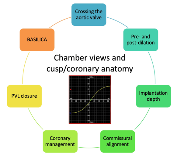 MilasinD18's tweet photo. Great education this morning in the Simulation Learning Room #PCRLV  Understanding how S-curves may be used for orientation at different steps of the TAVI procedure. @PCRonline @PamelaGatto @CurioJonathan @kiadeb87 @Sticchi_Alex @ABeneduceMD https://t.co/6VxTzR3wat