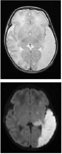 Biomedres01's tweet photo. Circulating HMGB-1, HistoneH3, and Syndecan-1 in a Newborn with Neonatal Cerebral Infarction by Toshihiko Nakamura, #BJSTR https://t.co/Jlg3Ilk5c8 https://t.co/zkcVbG7rpp