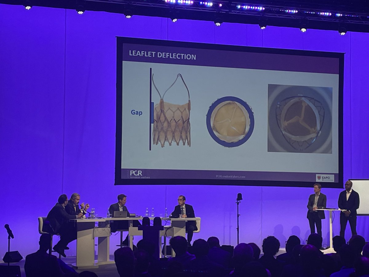 TAV-in-TAV…not so easy and many aspects to consider according to different #THVs and different device’s sizes!!! Thank you #PCRLV 2022! ⁦<a href="/PCRonline/">PCRonline 🫀</a>⁩ ⁦<a href="/dmylotte/">Darren Mylotte</a>⁩ @giuseppetarantini @OleDeBacker ⁦<a href="/GilbertTangMD/">Dr. Gilbert Tang</a>⁩ @urilandes #TAVI #TAVINTAV #valveinvalve