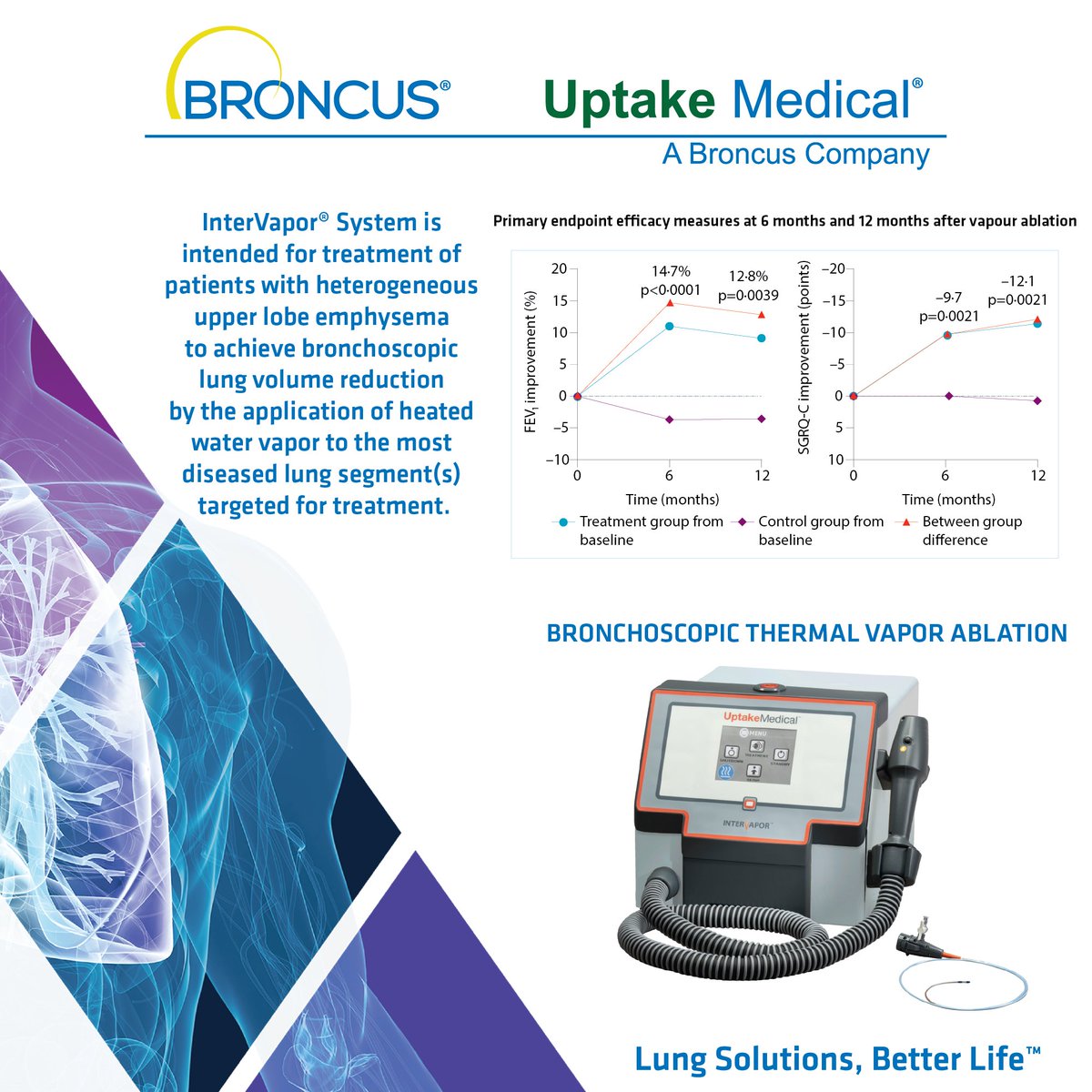 pulmonologyoa's tweet photo. Pulmonology On Air on behalf of Broncus Medical, Inc.
#Broncus #Bronchoscopy #lungcancer #lunghealth #InterventionalPulmonology #pulmoa #pulmonology #pulmonologists #bronchoscopists #medicaleducation #globalevent #COPD #denervation #exacerbations #bronchoscopy #RFablation https://t.co/O8SnTDhpLN