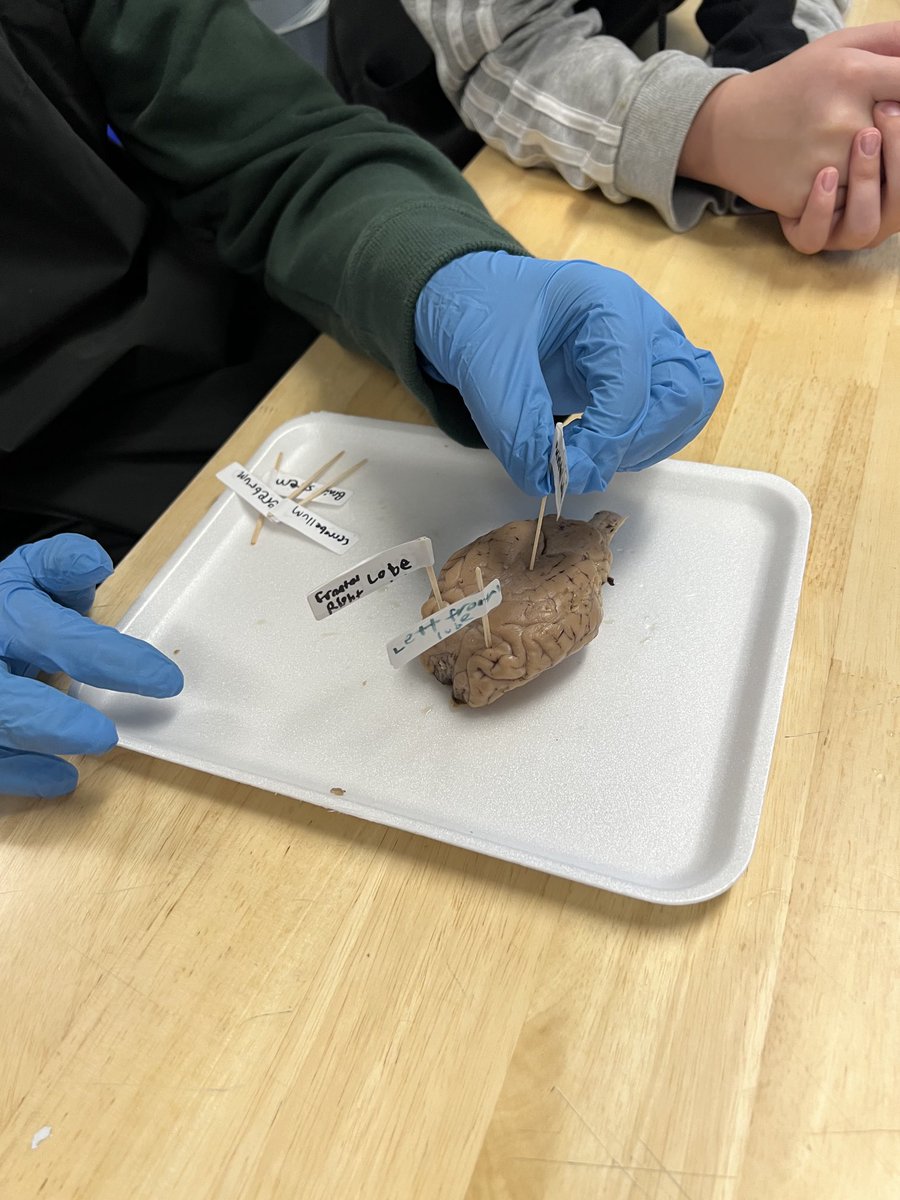 Baaaaa! ⁦<a href="/RogersMiddleSch/">Rogers Middle School</a>⁩ Ss doing sheep brain dissection in #MedicalDetectives #AfftonLearns ⁦@STLPLTW⁩ ⁦<a href="/PLTWorg/">Project Lead The Way</a>⁩