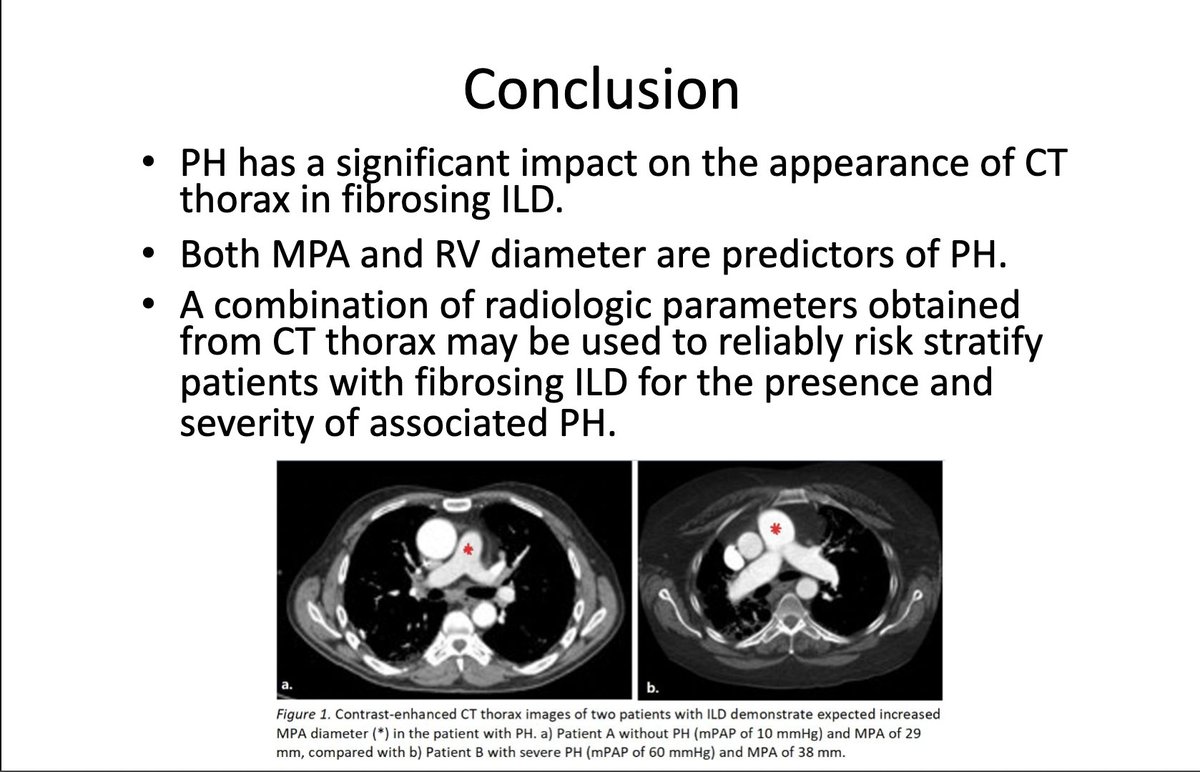 Fibrosing Interstitial Lung Disease often has a poor prognosis by itself, adding a late Dx of Pulmonary Hypertension, makes it significantly worse. This #RSNA22 poster by Lubna Siddiqi, MD from @westernurad inspects the presence of radiological markers in Fibrosing ILD cases 1/n