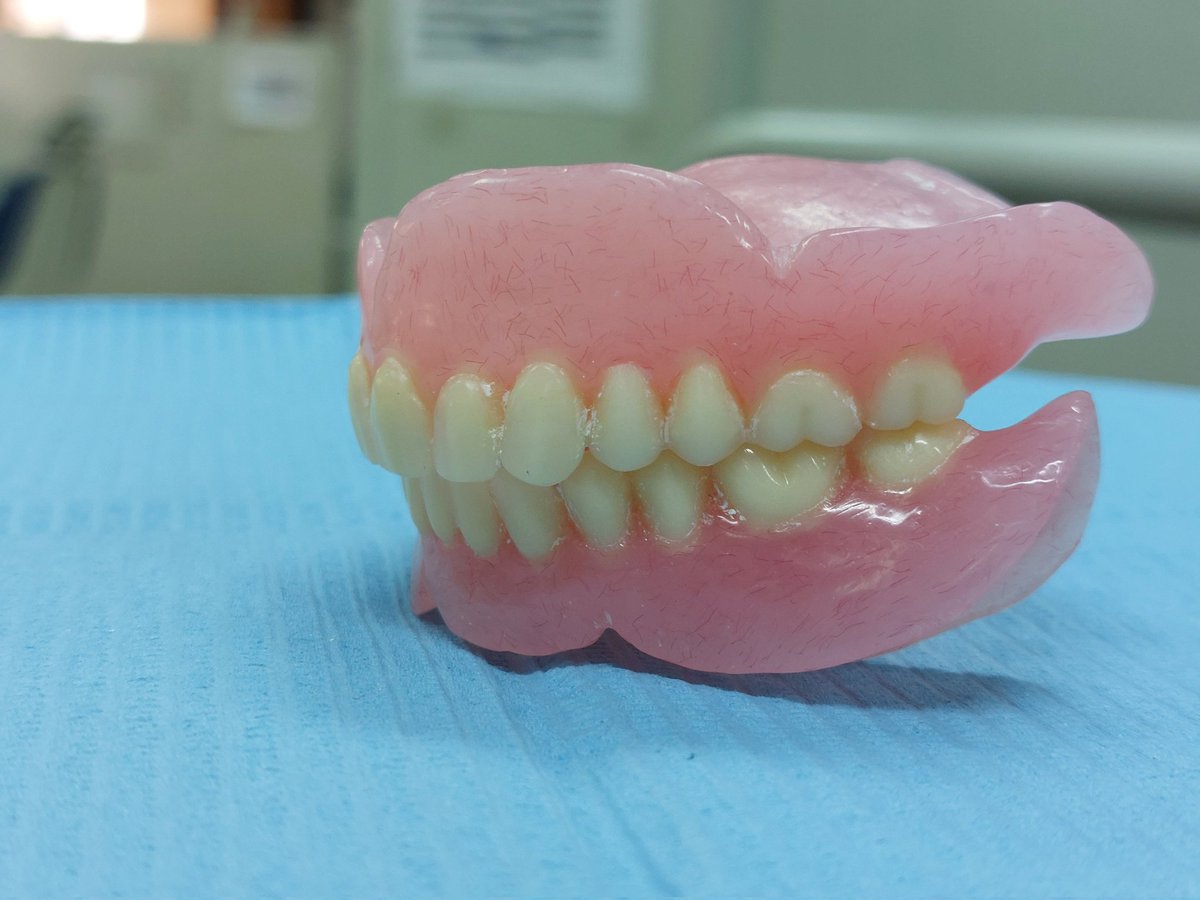 اللحظة المنتظرة من سنة اولي❤️
My first complete denture case🥰❤️🦷🦷
صغر عشر سنين 😂❤️❤️❤️