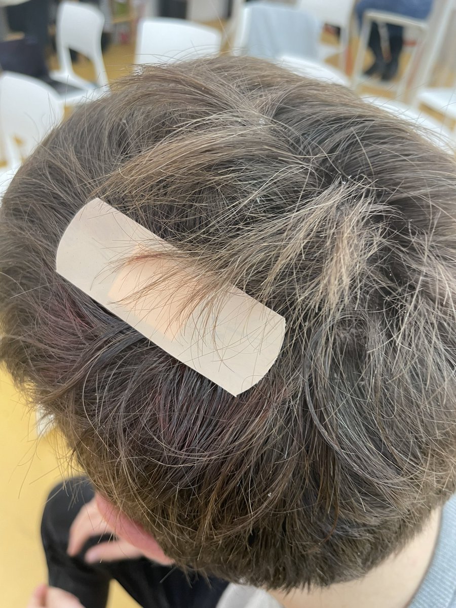 Serena Cangiano (@almostserena) on Twitter photo How is the hole in your head <a href="/faebser/">𝔽 𝕃 𝔸 𝕍 𝕀 𝔸 ℕ 𝕆</a>? How is the hole in your head <a href="/faebser/">𝔽 𝕃 𝔸 𝕍 𝕀 𝔸 ℕ 𝕆</a>?