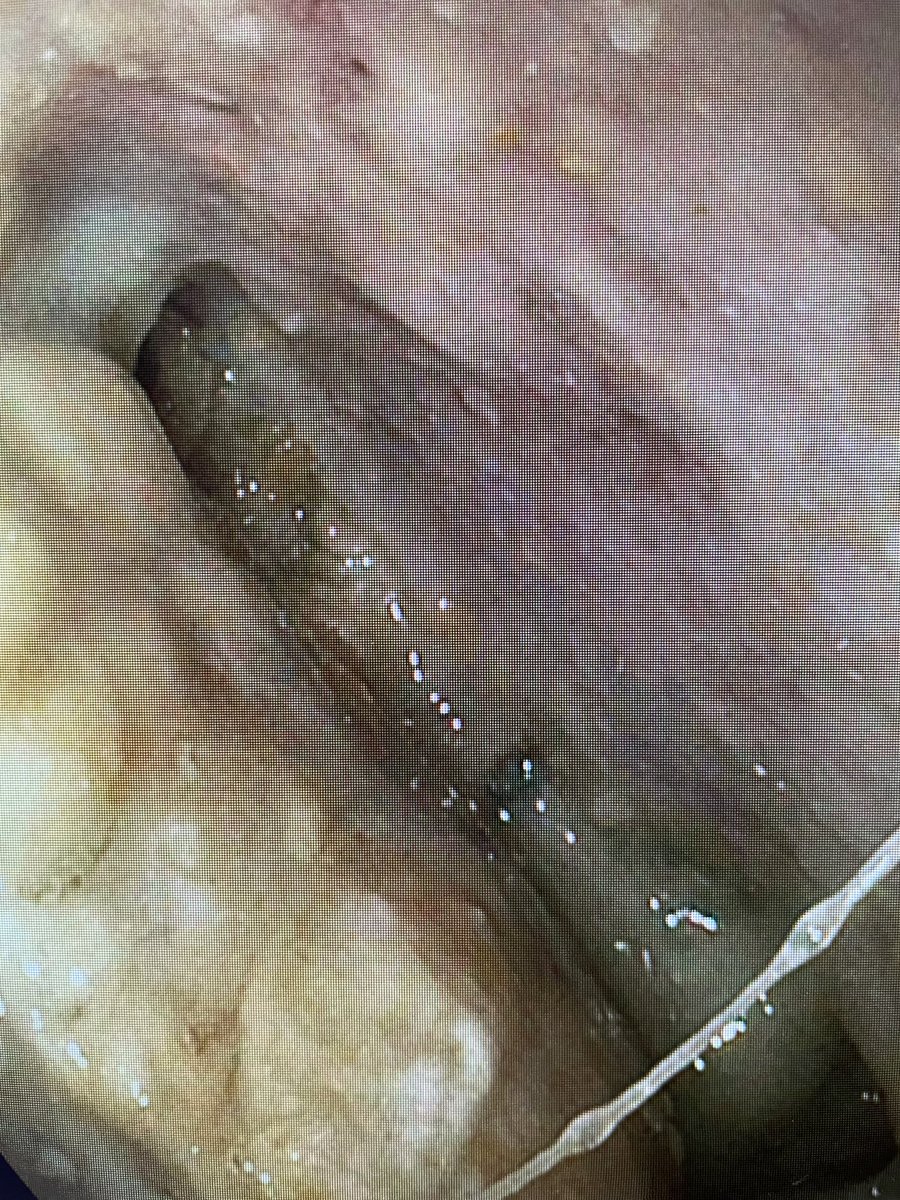 Douglas G. Adler MD, FASGE, FACG, AGAF tweet media