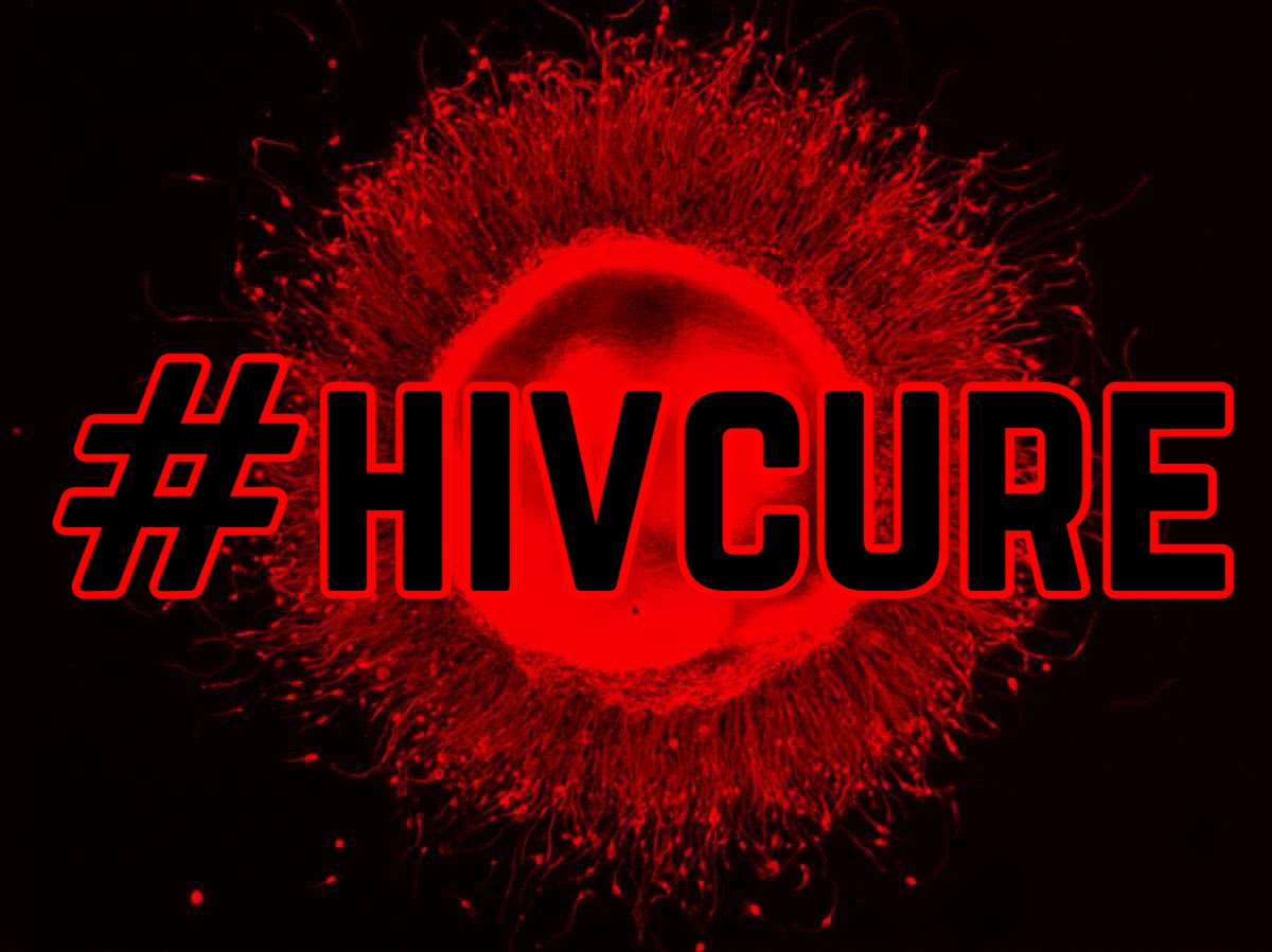 defeatHIV's tweet photo. A new study in Cell Reports explains why chronic inflammation may be happening in PWH and how suppression or even eradication of #HIV in the body may not resolve it. 

https://t.co/ej6CRbhmXn

#hivcure https://t.co/hcn5hPF1zP