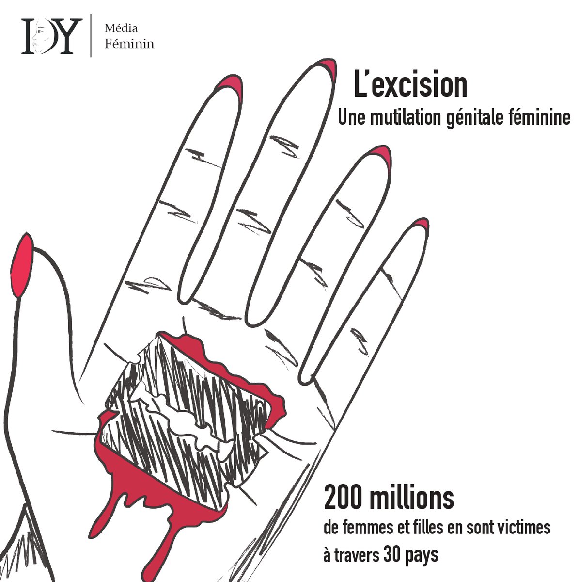idy_media's tweet image. L’excision constitue une violation brutale des droits humains et de l’intégrité des filles et des femmes qui a des conséquences violentes sur leurs vies. Aviez-vous déjà entendu parlé de l’excision avant? 
#alerteexcision #excisionparlonsen #femme
#msf #mutilationsexuelle