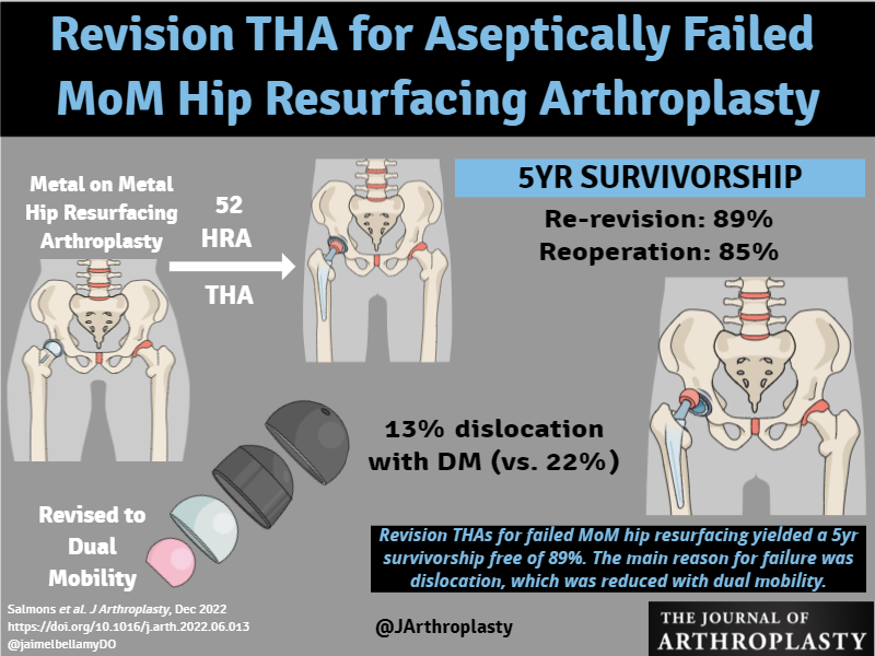 THAs for failed MoM HRA yielded 5yr survivorship free of re-revision of 89%. Main reason for failure was dislocation, which was reduced by dual mobility. <a href="/womenAAHKS/">WomenInArthroplasty</a> <a href="/kimtuckinAZ/">Kim Tucker, MD, FAAHKS, FAAOS</a> <a href="/BrdgPlt2Nowhere/">BridgePlate2Nowhere</a> @KevinWeiszMD <a href="/DrPeterGold/">Peter Gold MD</a> <a href="/alexusmcooper/">Alexus M. Cooper, MD</a> <a href="/CenterRotation/">Brock Howell MD, FAAOS</a> 

arthroplastyjournal.org/article/S0883-…