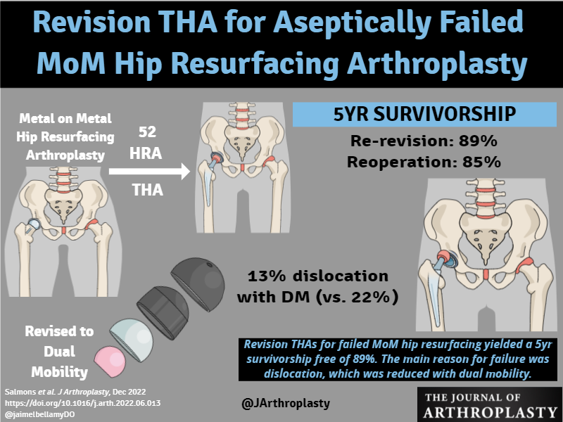 THAs for failed MoM HRA yielded 5yr survivorship free of re-revision of 89%. Main reason for failure was dislocation, which was reduced by dual mobility. @womenAAHKS @kimtuckinAZ @BrdgPlt2Nowhere @KevinWeiszMD @DrPeterGold @alexusmcooper @CenterRotation arthroplastyjournal.org/article/S0883-…