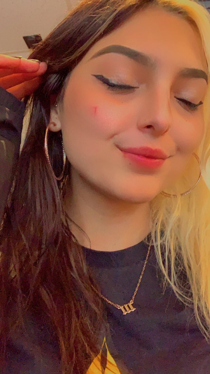 Woke up and busted my face on my bookshelf and left a mark that looks like a <a href="/Tesla/">Tesla</a> T😭 <a href="/elonmusk/">Elon Musk</a> now that I’m branded, can I have a Tesla👀