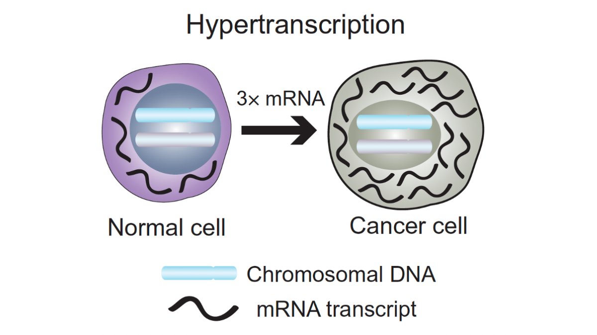 SickKidsNews's tweet photo. New #SKResearch led by Dr. Adam Shlien showcases RNAmp, a novel computational tool that directly measures hypertranscription in tumour cells, and highlights its potential to uncover previously unknown #cancer subtypes &amp; new treatment pathways for patients. https://t.co/JPAWC4mPK7 https://t.co/j5RICZMNpy