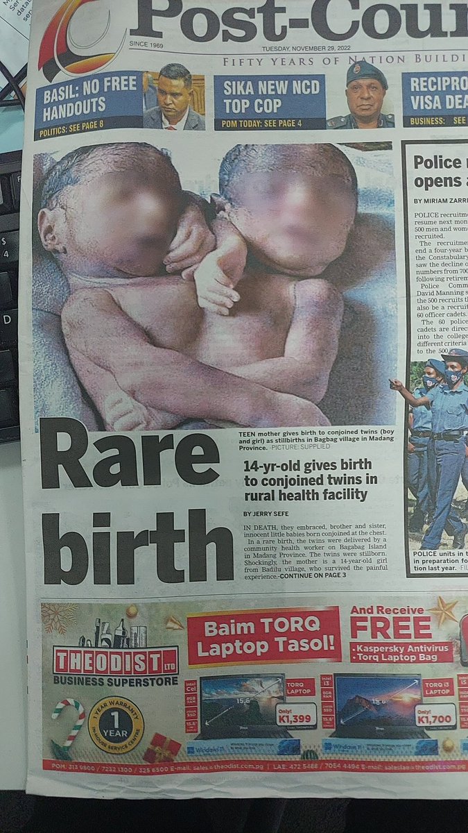 bernardsinai's tweet photo. Which is more shocking? The fact that the babies are conjoined twins? Or the fact that the mother is 14 years old? https://t.co/Z9P5JavDTo