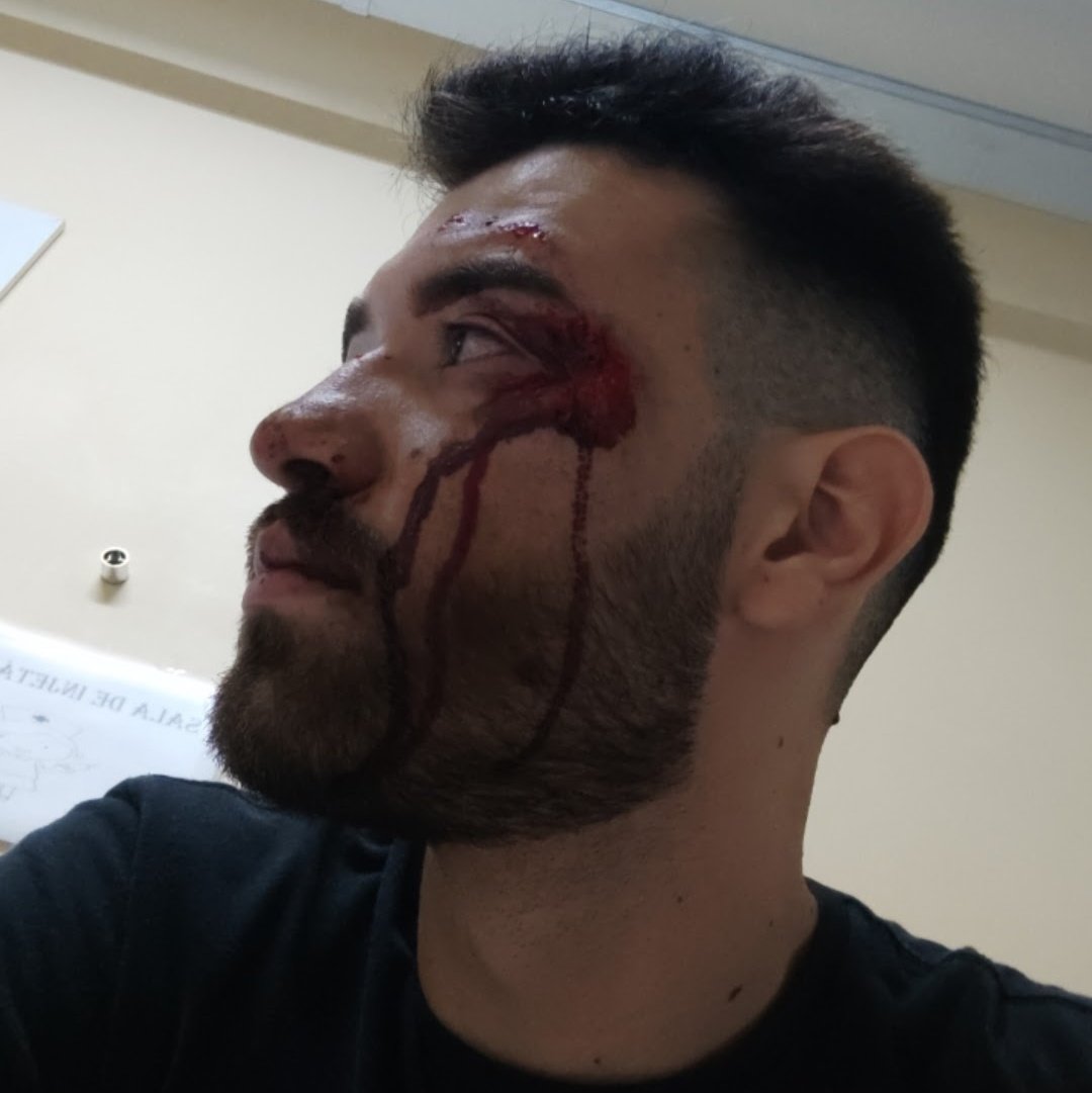 Quero deixar registrado aqui o dia que apanhei do marido da minha namorada.