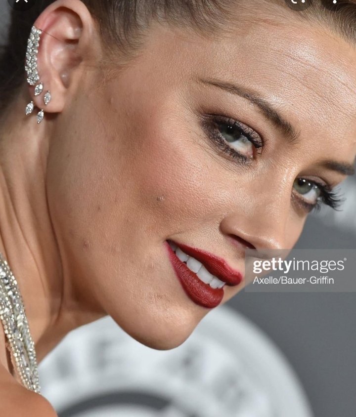 nebsynebau's tweet photo. Amber Heard wants people to believe that she managed to cover up her two black eyes, a broken nose and a busted lip with make up when she can't even successfully cover up her acne. 🥴🥴🥴🥴🥴 https://t.co/ABYJXW36iG
