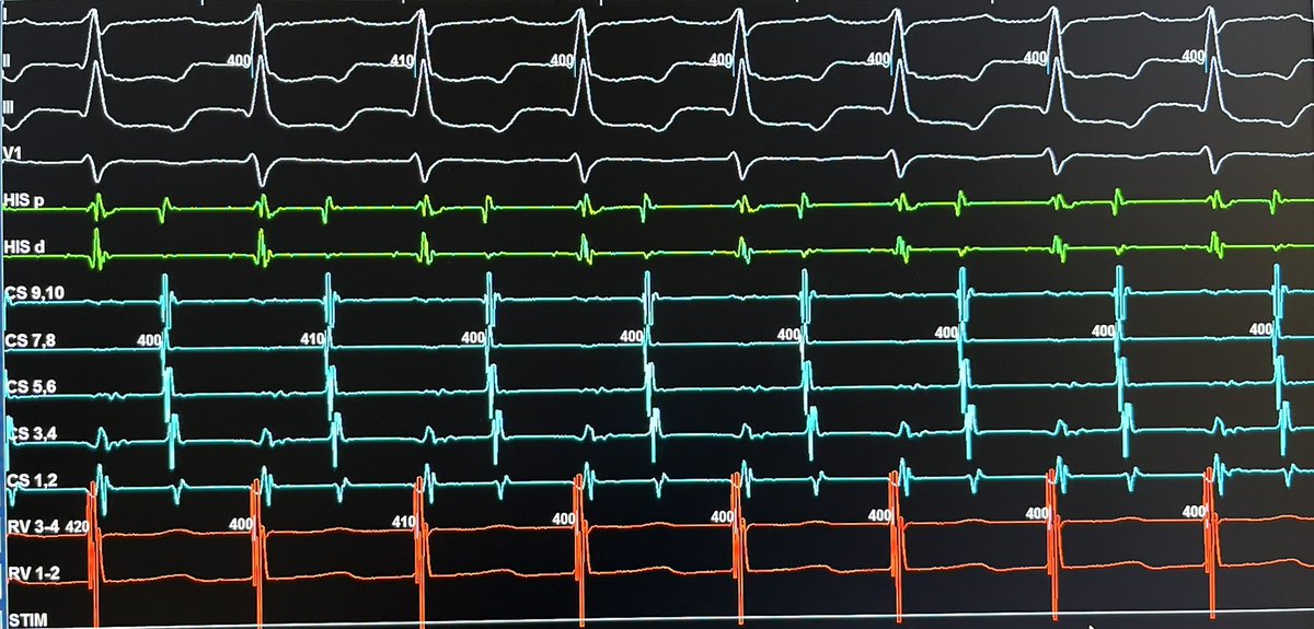 Patrick Dillon tweet media