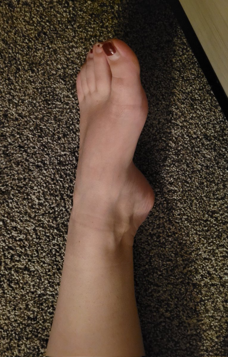 SummersSexyFeet's tweet photo. You can still see the sock line from work, want to smell them? 🥵 https://t.co/aEakrB73BA
