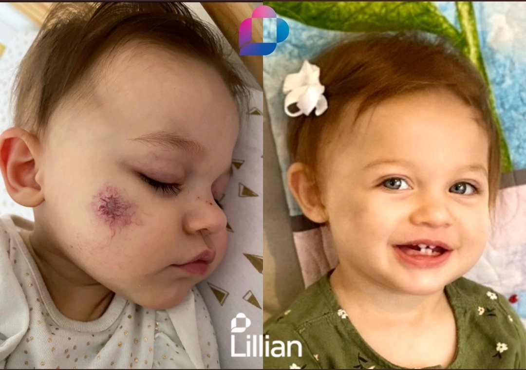Homeslice21love's tweet image. Medical blockchain, Healthcare, saving kids through surgery...

Yeah, @LillianFinance  about to change the future of health

#Ly #lilliantoken #Lillytoken