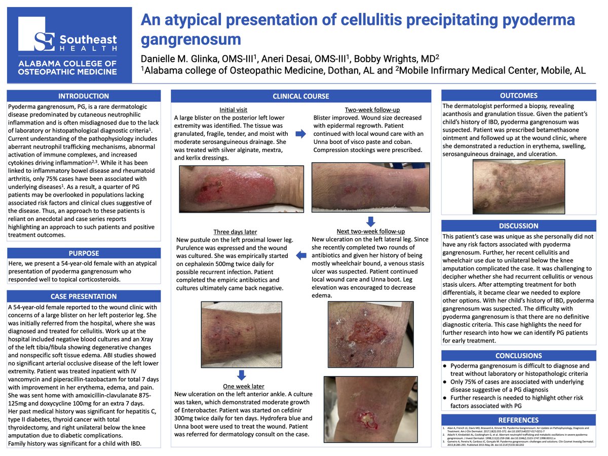 danigjohnston's tweet photo. Check out our poster on pyoderma gangrenosum! Video presentation below. @SocietyHospMed @ACOMEDU
 #shmWiregrass #ACOMposterday #WGCCV #CV312 #MedTwitter #dermtwitter https://t.co/1NELrmzhcf
