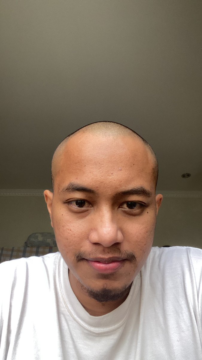 Hari ke 75 setelah konsultasi pertama ke Rs Fatmawati. Yang gua lakuin ga seberapa dibandingkan istri. Mau ingetin kalo dia ga berjuang sendiri yg belom tau ujungnya dimana. semoga lelah kami jadi Lillah