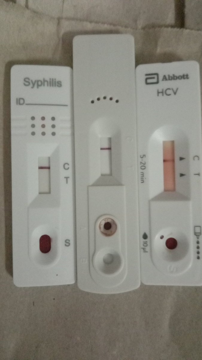 Eddyaisar's tweet photo. Ada yang ingin buat saringan kesihatan secara PERCUMA..boleh pm saya ..atau 0177019486, AREA JOHOR BAHRU 
#HIV
#HEP
#SIFILIS https://t.co/JmjbQDPmlx