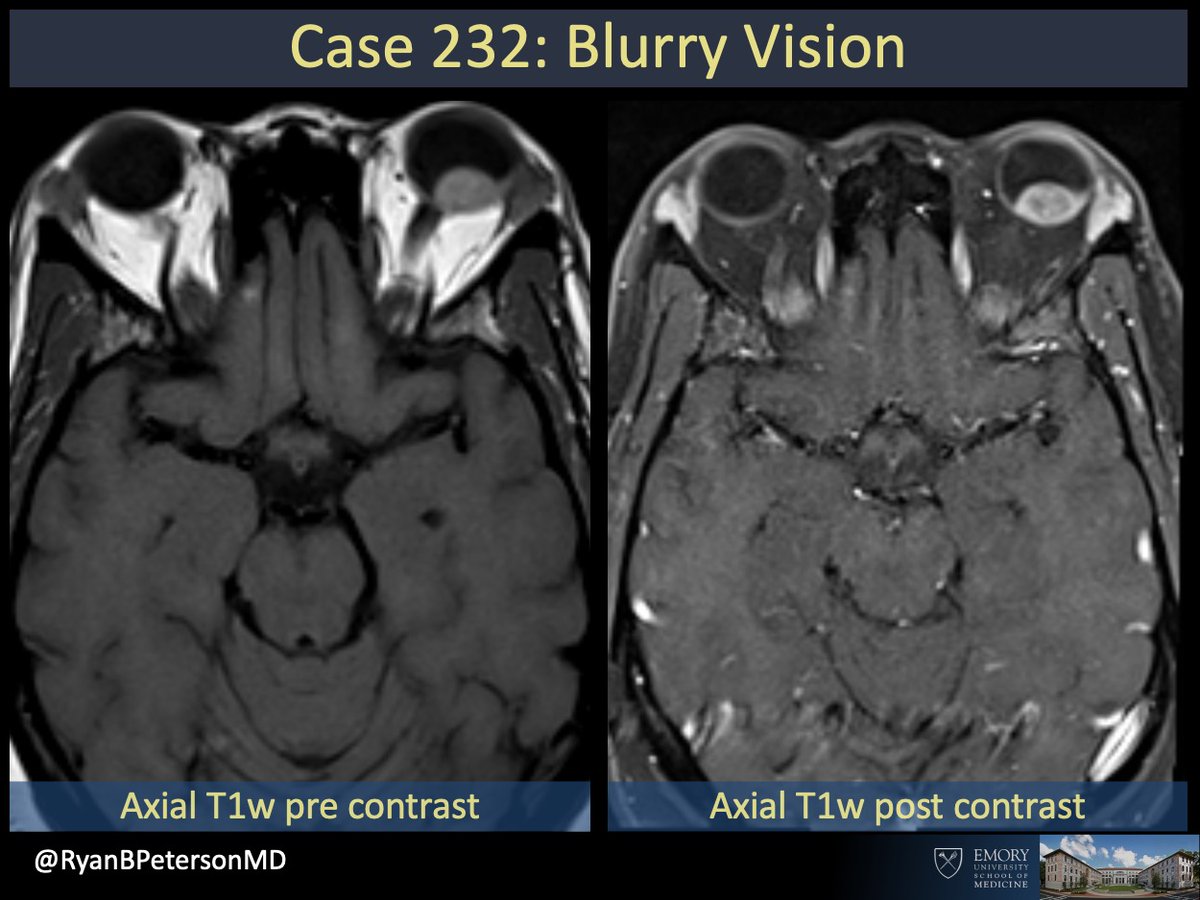 Ryan B Peterson 🇸🇪 tweet media