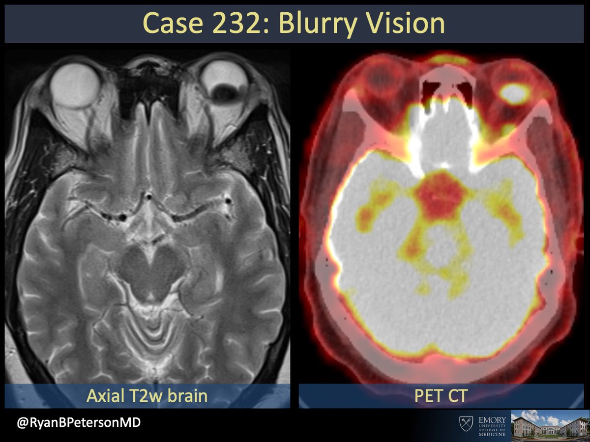 Ryan B Peterson 🇸🇪 tweet media