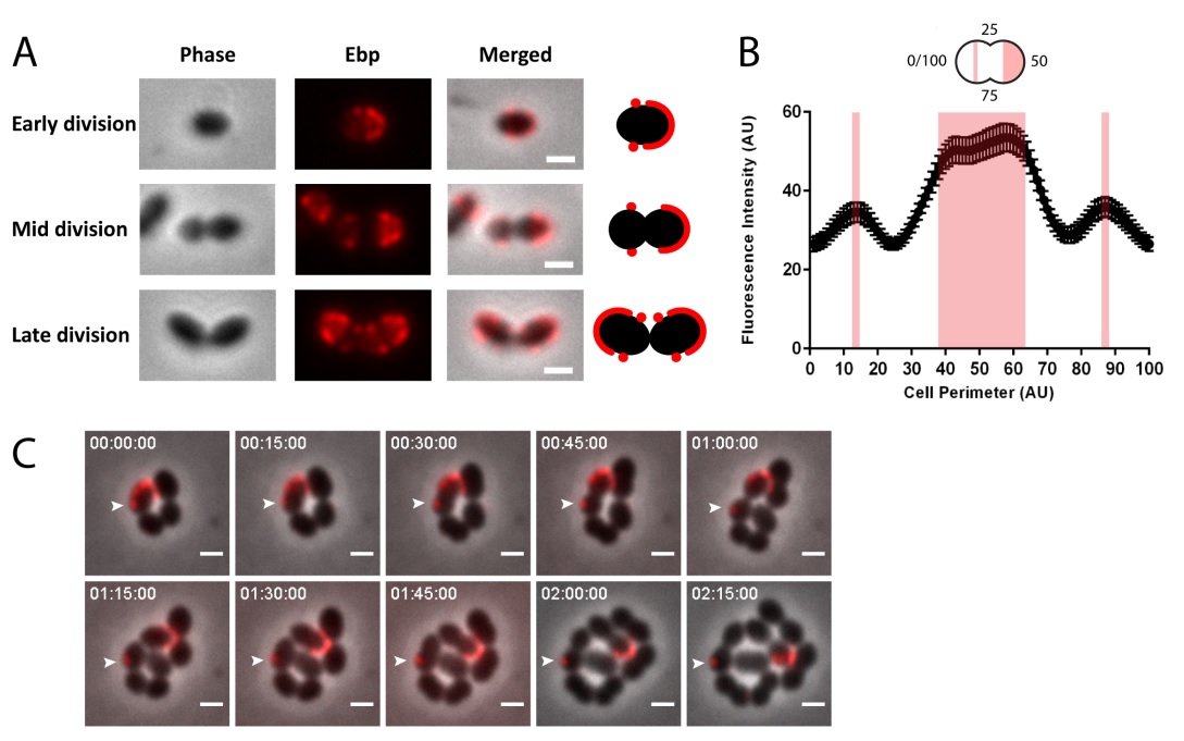 MolMicroEditors's tweet image. Check out this recently published paper by Choo et al. on spatial and temporal localization of cell wall associated #pili in Enterococcus faecalis @KimInGeneva @MIMOL_UNIGE @mvannieu_lab 
#sortase #microscopy
Read it here: onlinelibrary.wiley.com/doi/abs/10.111…