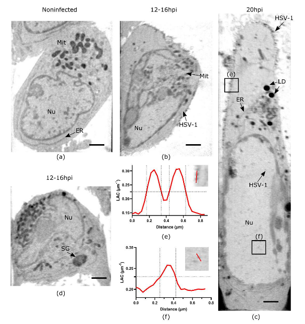 VirusesMDPI's tweet photo. Soft X-ray #Tomography Reveals #HSV-1-Induced Remodeling of Human B Cells 

Chen et al. demonstrate the power of #SXT imaging for scouting #virus-induced changes in infected cells and understanding the orchestration of virus-host remodeling quantitatively

https://t.co/8q2Y2vNg6U https://t.co/YQwGqwJOlm
