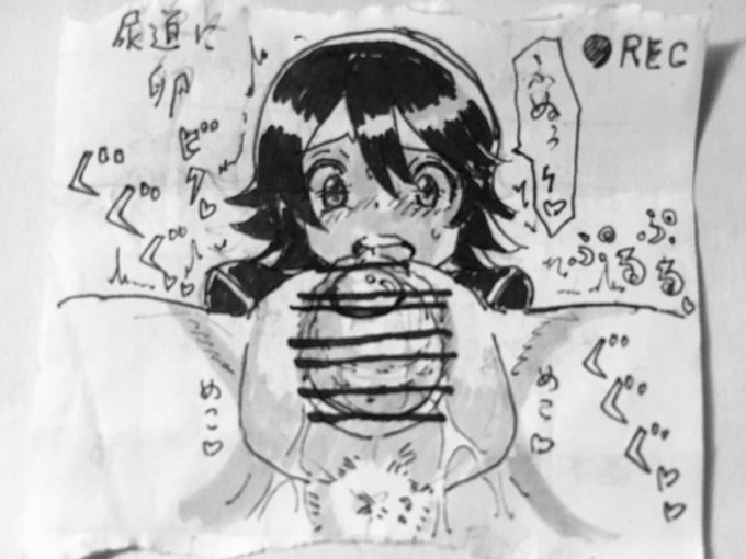 女子の尿道から卵🥚 