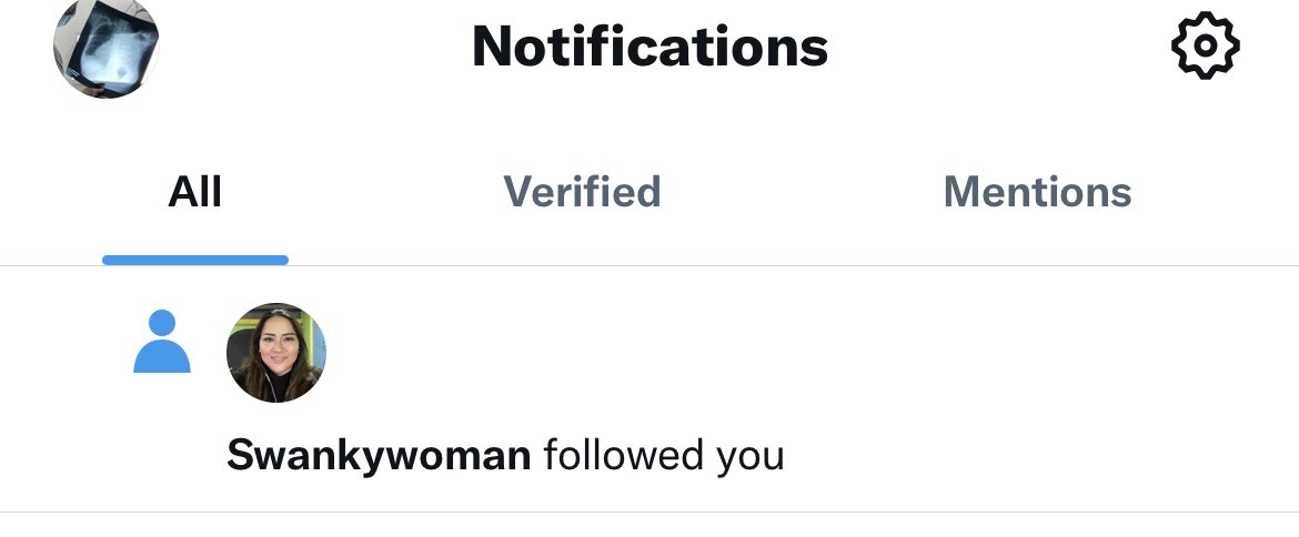 magingMDparin's tweet photo. Parang the world is listening to me. 😭 Was about to comment sa mga twt ni Doc Rocky kasi  natatamaan si meh. But pinag draft ko nalang kasi nahihiya ako. Di na kasi ako nag TN ulit kasi may f2f didto sa place namin. But huhu salamat ko Doc Rocky 😭🥹💓 I’m listening to you po. https://t.co/tWzN7iHCwt