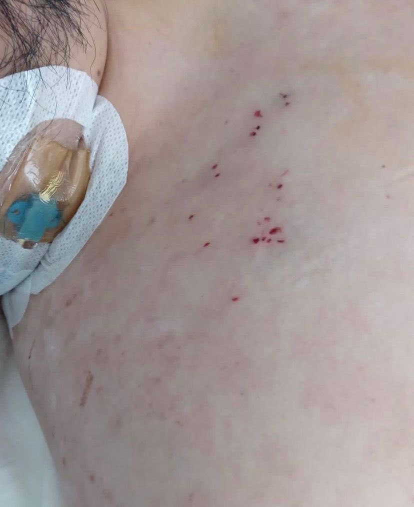 DrCriticalCare's tweet photo. Oye bro !!! No quieres el BUTTERFLY te lo Presto … NO !!! Deben aprender sin Ultrasonido …. Mmmmss y el px que culpa tiene bro https://t.co/rfkVliWnfw