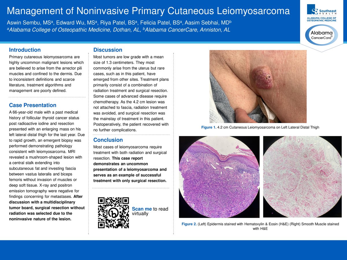 Excited to share our case report highlighting the treatment of a unique presentation of a cutaneous leiomyosarcoma!

<a href="/SocietyHospMed/">Society of Hospital Medicine</a> <a href="/ACOMEDU/">ACOM</a> #shmWiregrass #ACOMposterday #WGCCV <a href="/UF/">FLORIDA</a>