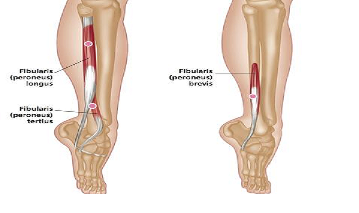 drdozellodc's tweet photo. Two Minutes of Anatomy: Peroneus Tertius AKA Fibularis Tertius
Dr Donald Ozello DC
#vegas #chiropractor #chiropractic #sportsmedicine #anatomy #anatomyandphysiology #foot #footanatomy #footmuscles #peroneustertius #fibularistertius #dorsiflexion #eversion https://t.co/jP3BcVKns5 https://t.co/4Lg32eFLJk