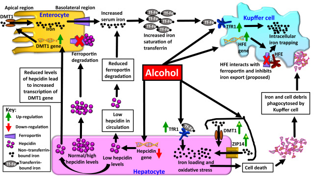 rabataller's tweet photo. Most patients with IRON overload that I've seen didn't have hemochromatosis. Rather, it was due to excessive alcohol intake.

Why does ALCOHOL induce such strong iron accumulation ?

This excellent review explains it all: https://t.co/gdNNtHXZJl

#livertwitter @medtwitter https://t.co/m0W319xMEY