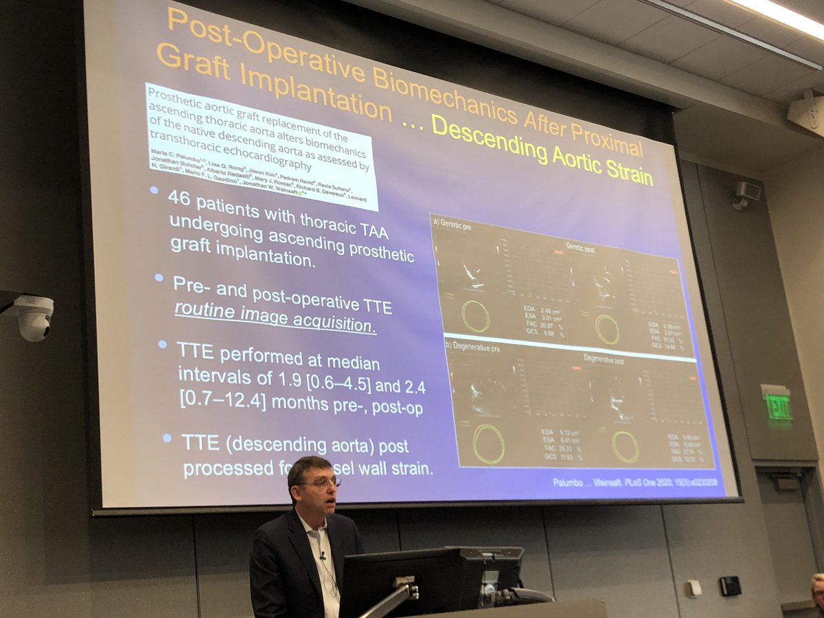 Sean M Wu, MD PhD (@seanm_wu) on Twitter photo Dr Jonathan Weinsaft at Cornell describing imaging enhanced hemodynamic studies ofbiomechanical factors driving thoracic aortopathy <a href="/StanfordCVI/">Stanford CVI</a> <a href="/WeillCornell/">Weill Cornell Medicine</a> CV Symposium. <a href="/StanfordDeptMed/">Stanford Department of Medicine</a> <a href="/StanfordMed/">Stanford Medicine</a> <a href="/Joseph_C_Wu/">Joseph C Wu, MD, PhD</a> Dr Jonathan Weinsaft at Cornell describing imaging enhanced hemodynamic studies ofbiomechanical factors driving thoracic aortopathy <a href="/StanfordCVI/">Stanford CVI</a> <a href="/WeillCornell/">Weill Cornell Medicine</a> CV Symposium. <a href="/StanfordDeptMed/">Stanford Department of Medicine</a> <a href="/StanfordMed/">Stanford Medicine</a> <a href="/Joseph_C_Wu/">Joseph C Wu, MD, PhD</a>