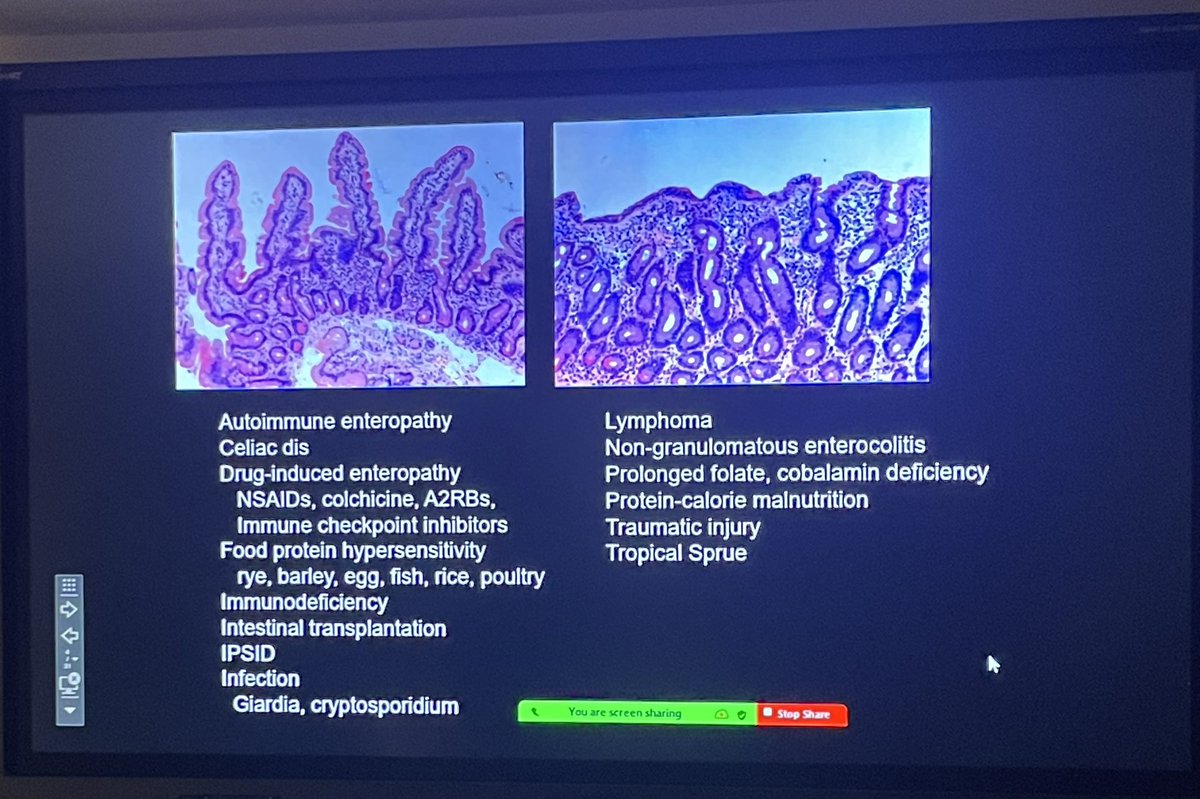 Montefiore Gastroenterology tweet media
