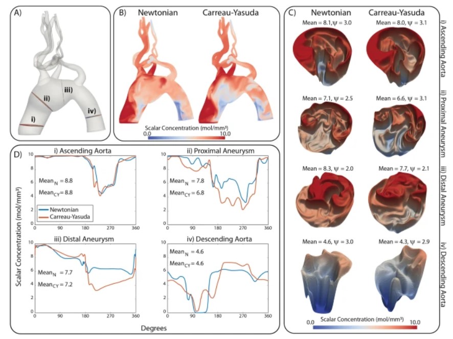 C. Alberto Figueroa (@bloodflowsim) on Twitter photo Congratulations to <a href="/sabrinarlynch/">Sabrina Lynch, PhD</a> and <a href="/NiteshNama6/">Nitesh Nama</a> on their work studying the effects of ๐ป๐ผ๐ป-๐ก๐ฒ๐๐๐ผ๐ป๐ถ๐ฎ๐ป ๐๐ถ๐๐ฐ๐ผ๐๐ถ๐๐ on ๐ฎ๐ฟ๐๐ฒ๐ฟ๐ถ๐ฎ๐น and ๐๐ฒ๐ป๐ผ๐๐ ๐ณ๐น๐ผ๐ & ๐๐ฟ๐ฎ๐ป๐๐ฝ๐ผ๐ฟ๐!
nature.com/articles/s4159โฆ
<a href="/UMBME/">U-M BME</a> <a href="/umichCVC/">U-M Health Frankel CVC</a> <a href="/UM_MICDE/">MICDE</a> <a href="/UoMVascSurgery/">UoM Vascular Surgery</a> Congratulations to <a href="/sabrinarlynch/">Sabrina Lynch, PhD</a> and <a href="/NiteshNama6/">Nitesh Nama</a> on their work studying the effects of ๐ป๐ผ๐ป-๐ก๐ฒ๐๐๐ผ๐ป๐ถ๐ฎ๐ป ๐๐ถ๐๐ฐ๐ผ๐๐ถ๐๐ on ๐ฎ๐ฟ๐๐ฒ๐ฟ๐ถ๐ฎ๐น and ๐๐ฒ๐ป๐ผ๐๐ ๐ณ๐น๐ผ๐ & ๐๐ฟ๐ฎ๐ป๐๐ฝ๐ผ๐ฟ๐!
nature.com/articles/s4159โฆ
<a href="/UMBME/">U-M BME</a> <a href="/umichCVC/">U-M Health Frankel CVC</a> <a href="/UM_MICDE/">MICDE</a> <a href="/UoMVascSurgery/">UoM Vascular Surgery</a>