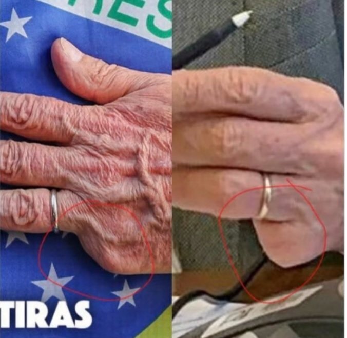 NossaRenovacao's tweet photo. A Chance dessas 2 mãos pertencer a Mesma Pessoa É Zero ! https://t.co/Rs2KDNtVkD