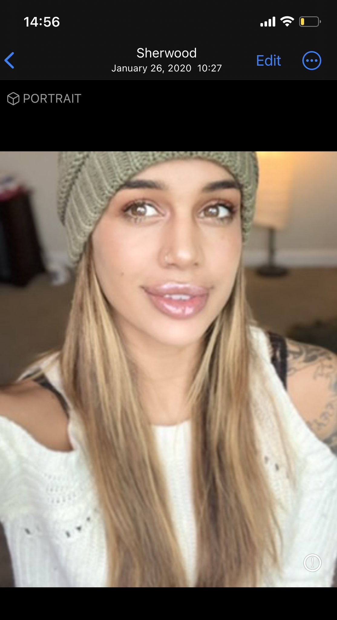 Jazmyn on Twitter "this is your sign to dissolve your lip filler and